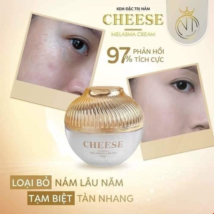Kem Face Nám Melasma Cheese